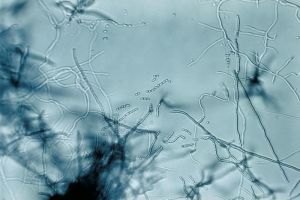 Image streptomyces.jpg