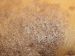 Maladies-Dartrose tubercule Ephytia-INRAE.jpg
